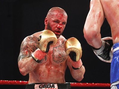 Vérfürdő Székesfehérváron